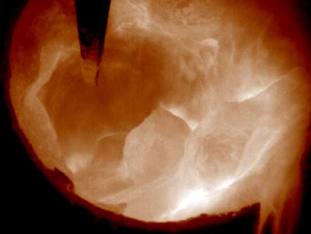 鋅回收用氧化鋅回轉(zhuǎn)窯結(jié)塊監(jiān)控